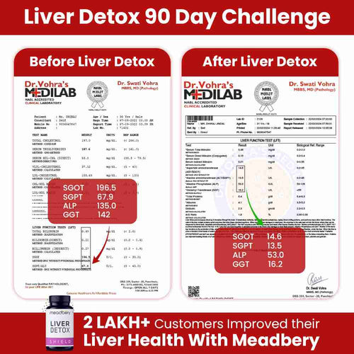 Liver Detox +